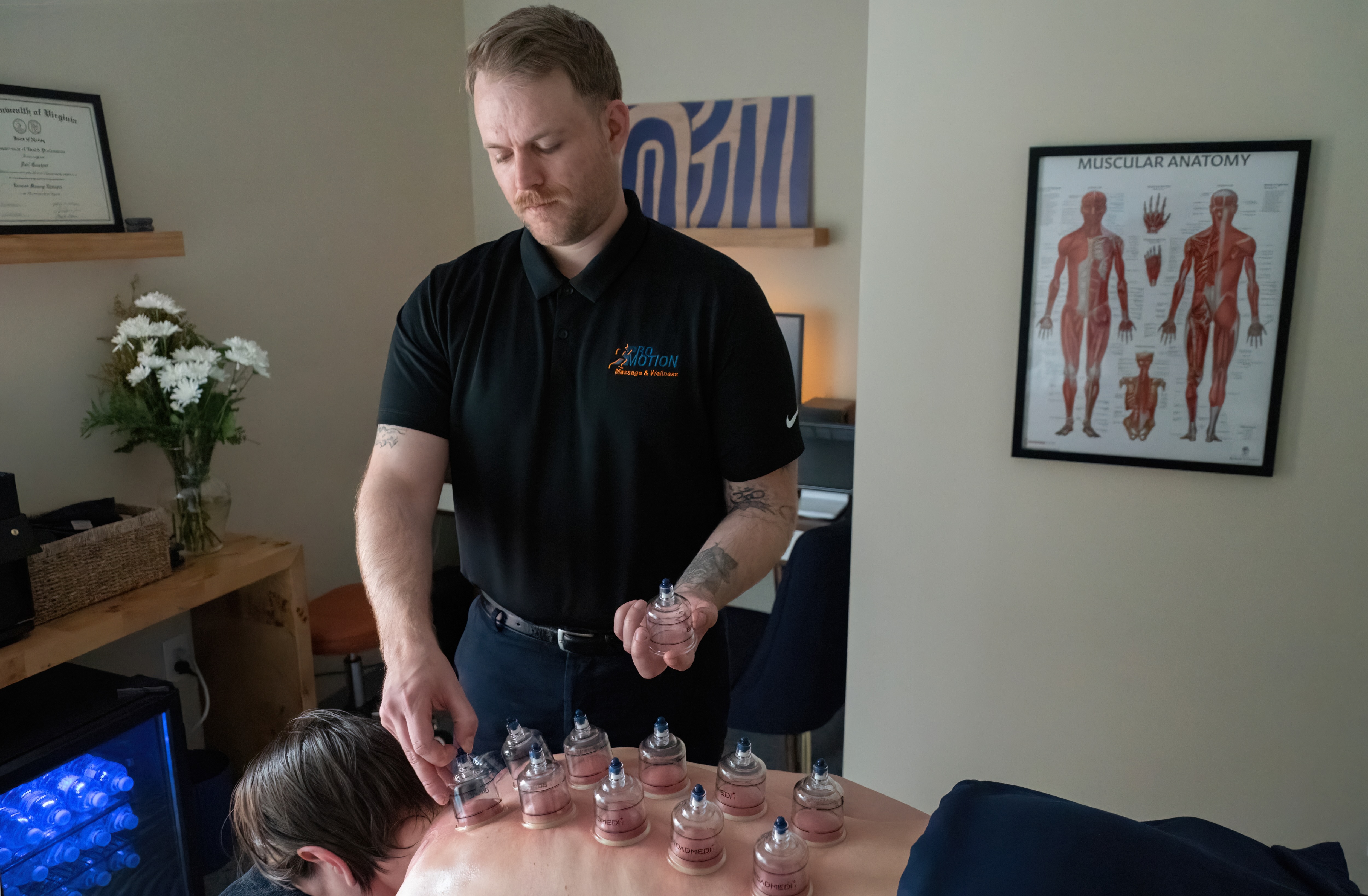 Cupping Therapy